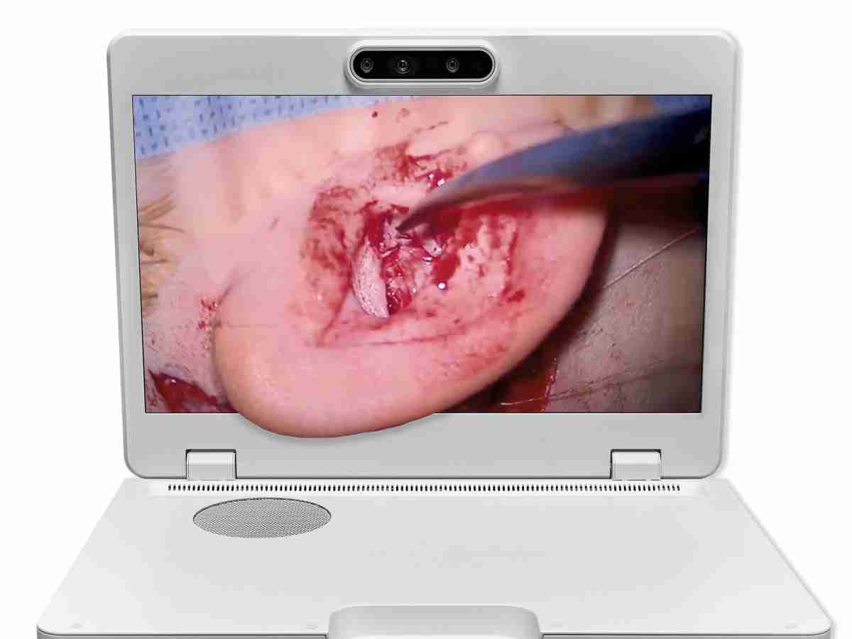 达擎之＂Heads-up 3D显微手术显示系统＂，，，，整合4K裸眼3D显示及眼球追踪系统，，具备快速追踪人眼移动位置功能，，，减轻医师长时间维持固定姿势的负担，，，，让医师能有更宽广清晰的3D立体视野及更舒适的姿势来执行手术。。。。